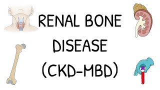 Renal Bone Disease CKDMBD  Explained simply and clearly [upl. by Sida]