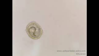 Embryonated Toxocara egg │wwwuplbparaslabwebscom [upl. by Kopaz299]