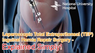 Laparoscopic Total Extraperitoneal TEP Inguinal Hernia Repair Surgery  Explained [upl. by Oettam]