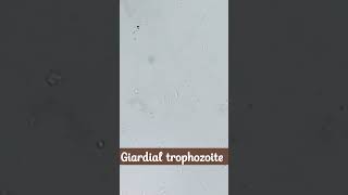 Microscopic identification of Giardia lamblia  cysts and trophozoite [upl. by Lilybelle]