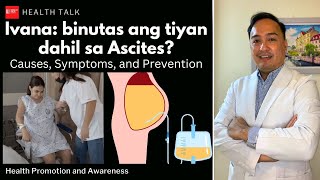 Bakit binutas ang tiyan ni Ivana Ascites Causes Symptoms and Prevention [upl. by Htidirrem]