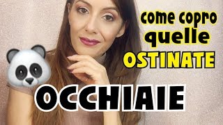 OCCHIAIE COME COPRO QUELLE OSTINATE [upl. by Enaej]