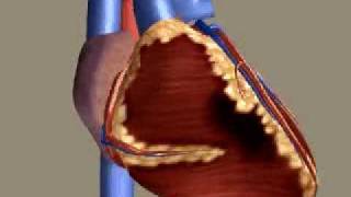 Myocardial Infarction [upl. by Namhcan763]