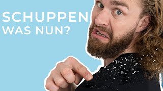 5 einfache TIPPS gegen Schuppen ● Haarstyling Tipps für Männer [upl. by Clement]