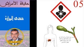 حقيقة حصى المرارة  الدكتور محمد فائد [upl. by Raimondo]