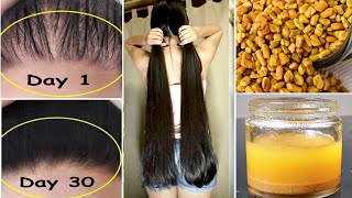 15 Days Challenge  Extreme Hair Growth  Worlds Best Faster Remedy for Hair Growth [upl. by Yoko]