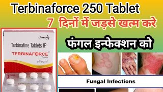 Terbinaforce Tablet Terbinafine 250mg Tablet Antifungal Tablet Fungal Infection Treatment [upl. by Suirtimed40]