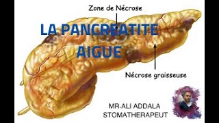 LA PANC REATITE AIGUE [upl. by Anujra]