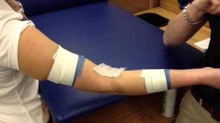 Elbow Hyperextension Taping [upl. by Leahcar]