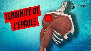 COMPRENDRE LA TENDINITE DE LÉPAULE Explications professionelles [upl. by Micro]