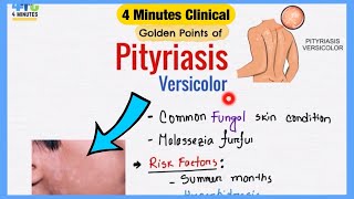 Pityriasis Versicolor Explained Like Water  Symptoms Pathogenesis Treatment  4 Minutes Clinical [upl. by Averir392]