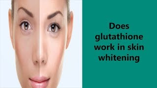 Does Glutathione Work In Skin Whitening [upl. by Nohsyar]