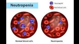 NEUTROPENIA  Definition of neutropenia  Causes of neutropenia [upl. by Nicholson994]