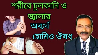 শরীরে জ্বালা ও চুলকানির অব্যর্থ হোমিও ঔষধ  dr SP Goswami [upl. by Luz]