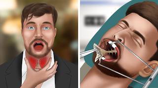 ASMR Animation Remove fish bones stuck in MrBeasts throat [upl. by Khosrow]