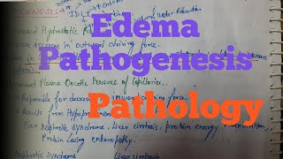 Edema Pathogenesis [upl. by Card]