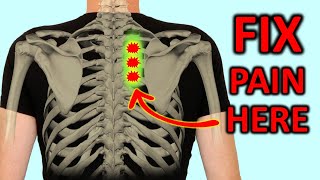 quotRhomboid Painquot How To Fix Shoulder Blade Pain Quickly [upl. by Eicirtap]