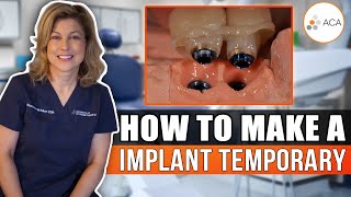 How To Fabricate A Implant Provisional [upl. by Anelram250]