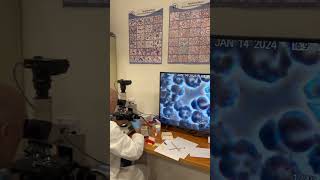 Im studying the condition of your 🩸 medicine microscope doctor channel shorts [upl. by Suravaj]