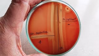 CAMP test for Streptococcus agalactiae  GBS [upl. by Cavit]