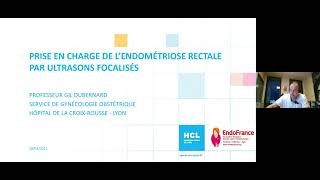 Prise en charge miniinvasive de lendométriose par ultrasons Résultats détudes amp perspectives [upl. by Nauqram]