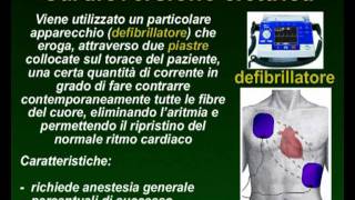 Cardioversione della fibrillazione atriale [upl. by Ramsa]