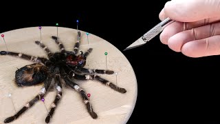 WHATS INSIDE THE SPIDER AUTOPSY DIED SPIDER AND LOOK UNDER THE MICROSCOPE [upl. by Mollie943]