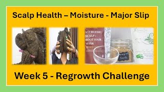 How to Regrow Menopausal Hair Loss Naturally  Week 5 [upl. by Yesak]