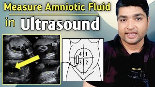 The Basic Fetal Heart Scan [upl. by Ainessej361]