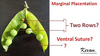 Marginal Placentation Explained NBD5 kexam NEET [upl. by Anaeco]