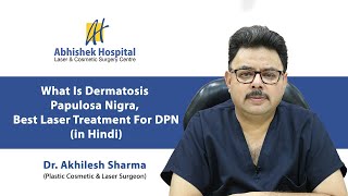 What Is Dermatosis Papulosa Nigra Best Laser Treatment For DPN In Hindi [upl. by Barr]