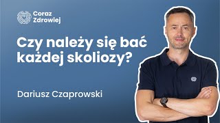 12 Czy należy się bać każdej skoliozy [upl. by Keisling]