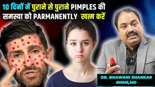 5 Most Effective Homeopathic Remedies for Pimples and acne  10 दिनों के अंदर Pimples गायब [upl. by Aikar]