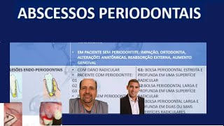 Abscessos periodontais e lesões endo perio Dr Alex Guedes [upl. by Alaunnoif372]