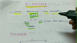 glaucoma part 1 ophthalmology  types of glaucoma  clinical presentation  management [upl. by Emee]