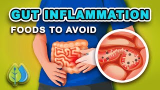 Top 5 Foods that Cause GUT Inflammation  AVOID  eat these anti inflammatory foods [upl. by Ianahs]