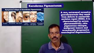 XERODERMA PIGMENTOSUM SAM BIOLOGY 🧫 CLASS [upl. by Verdi]