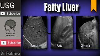 Liver normal echogenicity amp fatty liver with texture complete ultrasound lecture by DrFatima [upl. by Eniawed]