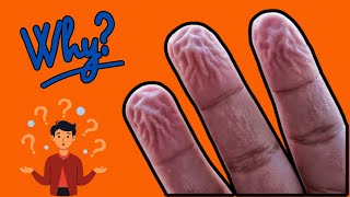 Why Do Our Fingers Wrinkle in Water [upl. by Franklin]