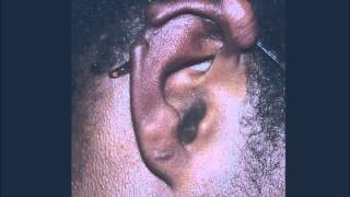 Removing Keloids at home with Rubber Bands  Causing Permanent Damage [upl. by Lyndon]