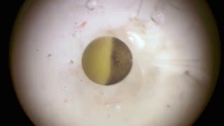 Frog oocyte microinjection [upl. by Anabel]