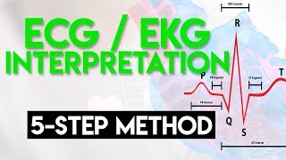 ECG Interpretation Made Easy  ECG EKG Interpretation Part 2 [upl. by Eneladgam]