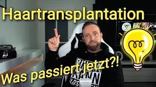 Haartransplantation  Was passiert jetzt [upl. by Ltney]