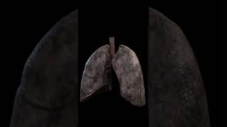 This Is What Happens to Your Lungs When You Smoke [upl. by Toddie]