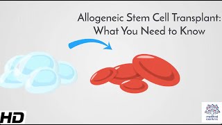 Allogeneic Stem Cell Transplant What You Need to Know [upl. by Annoel]