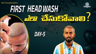 how to do first head wash  first head wash  ofter transplant process [upl. by Hnirt770]