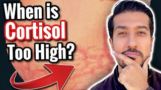 5 Signs of High Cortisol to NOT IGNORE  What Lowers Cortisol [upl. by Cailly753]