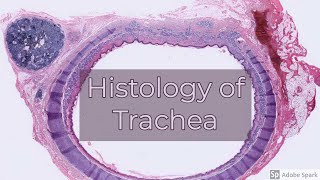 Histology of Trachea [upl. by Pihc156]