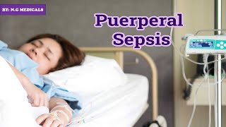 puerperal sepsis part 1 NGMedicals [upl. by Ahtiek89]