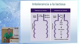 INTOLERANCIA A LA LACTOSA [upl. by Bryant]